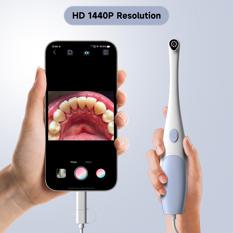 Oral Endoscope Camera 1440P Ph - Photography Lighting Description 评论和价格