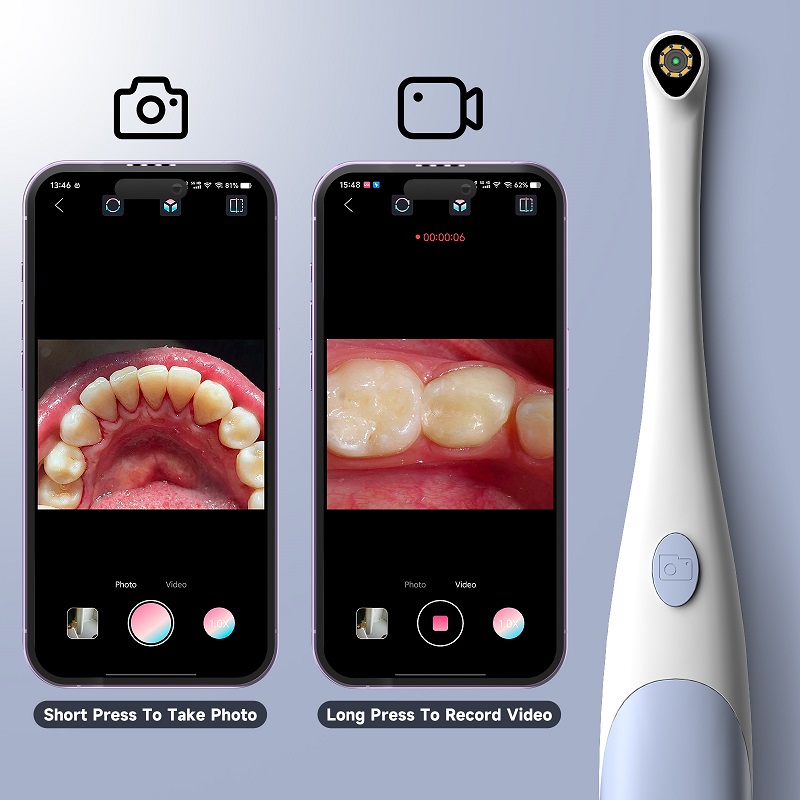 Oral Endoscope Camera 1440P Ph - Photography Lighting Description 评论和价格